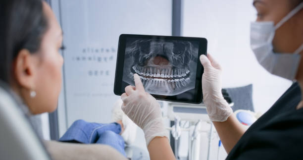 Licensed Invisalign Clear Aligners service in Webster, FL - Smile Center Dentistry